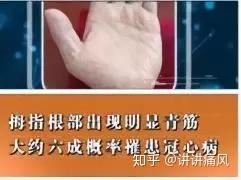 血管好不好 自己看看手就知道 这5个地方长青筋太危险 知乎