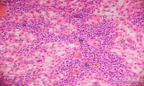 图10-7淋巴结的髓质(淋巴结 he染色10×10) 图示淋巴结髓质的髓索(※)