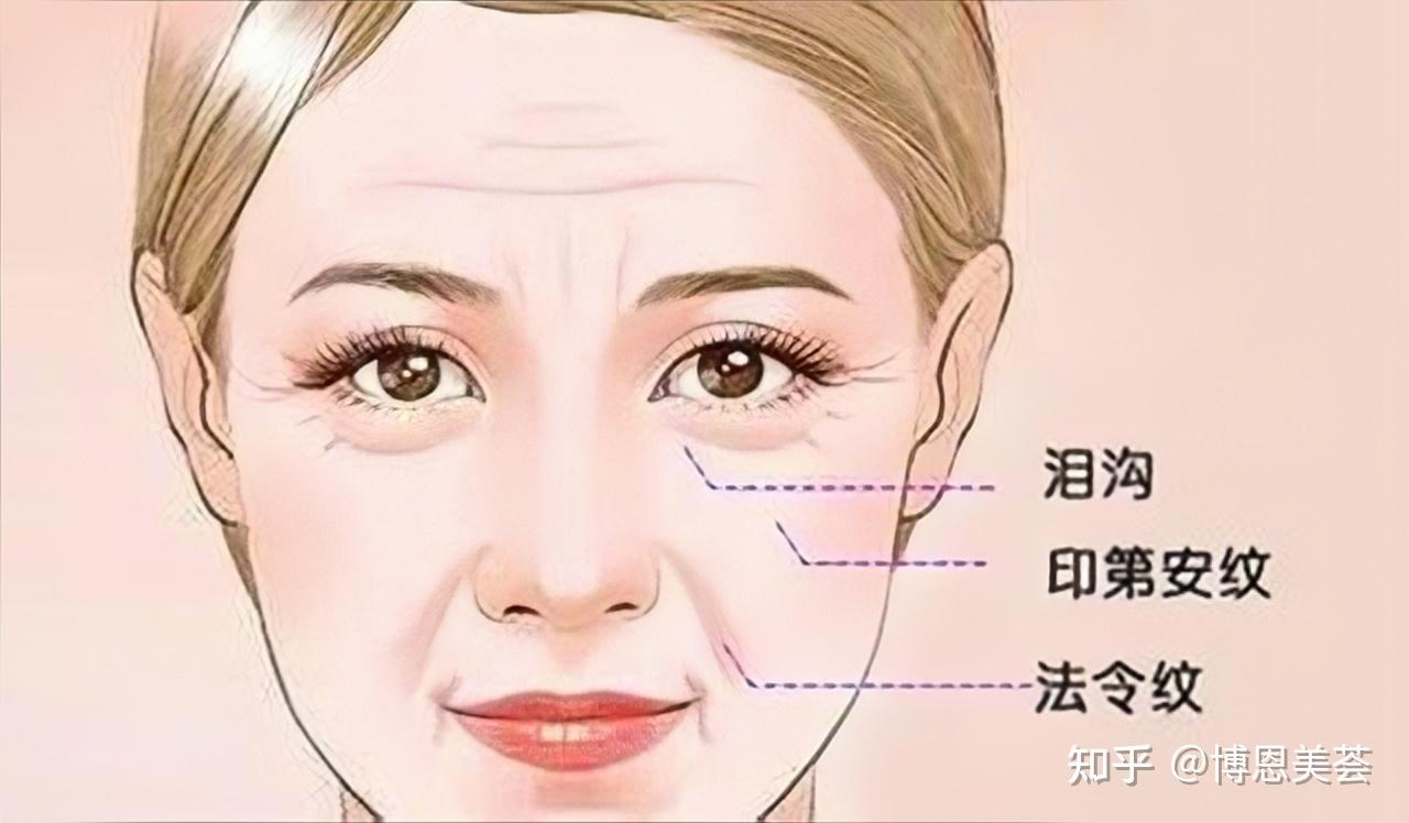 泪沟和印第安纹还有关联?你不会还傻傻分不清吧 - 知乎