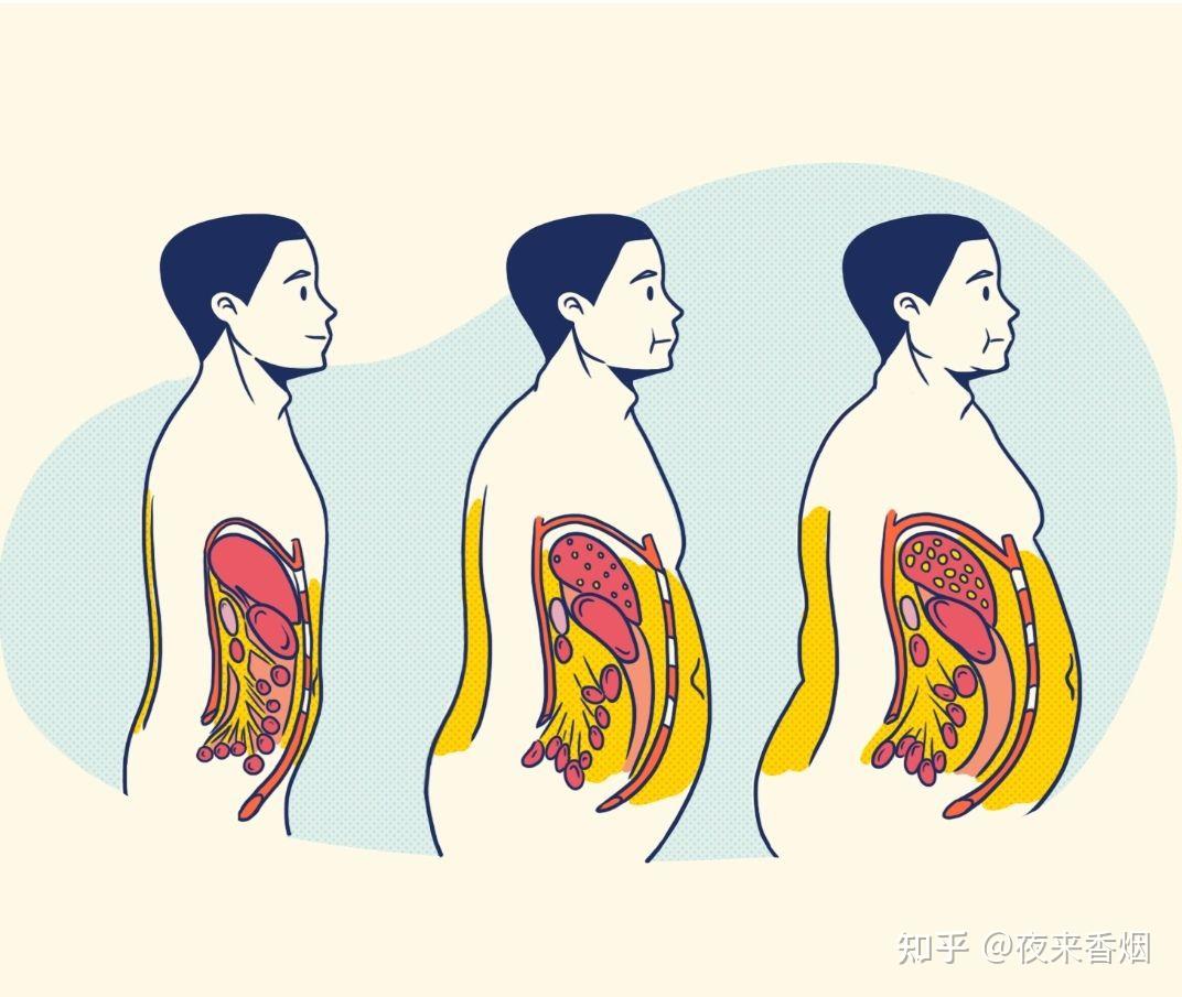 男性脂肪分布图图片