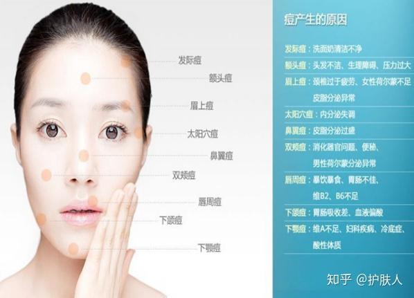 常见的皮肤问题(痘痘) - 知乎