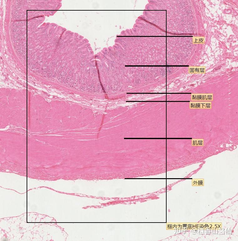 胃底腺图片图片