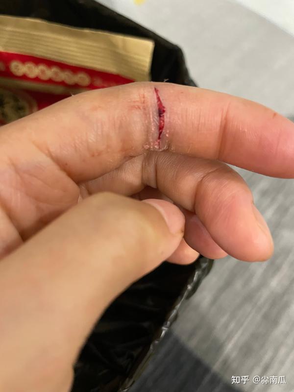 一把陶瓷刀割伤以后我来更新啦