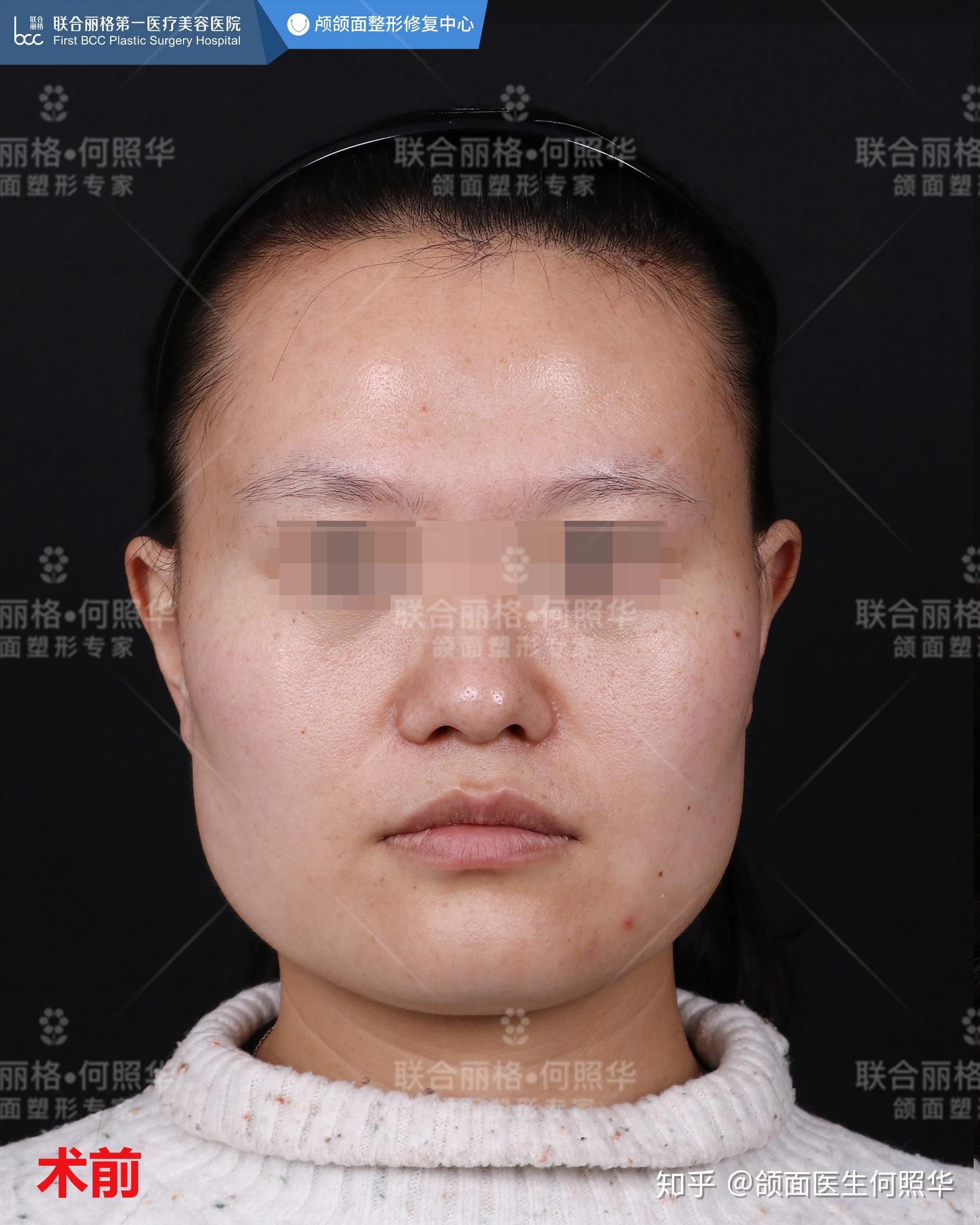 颧骨和额头差不多宽下颔有点方尖下巴属于什么脸型