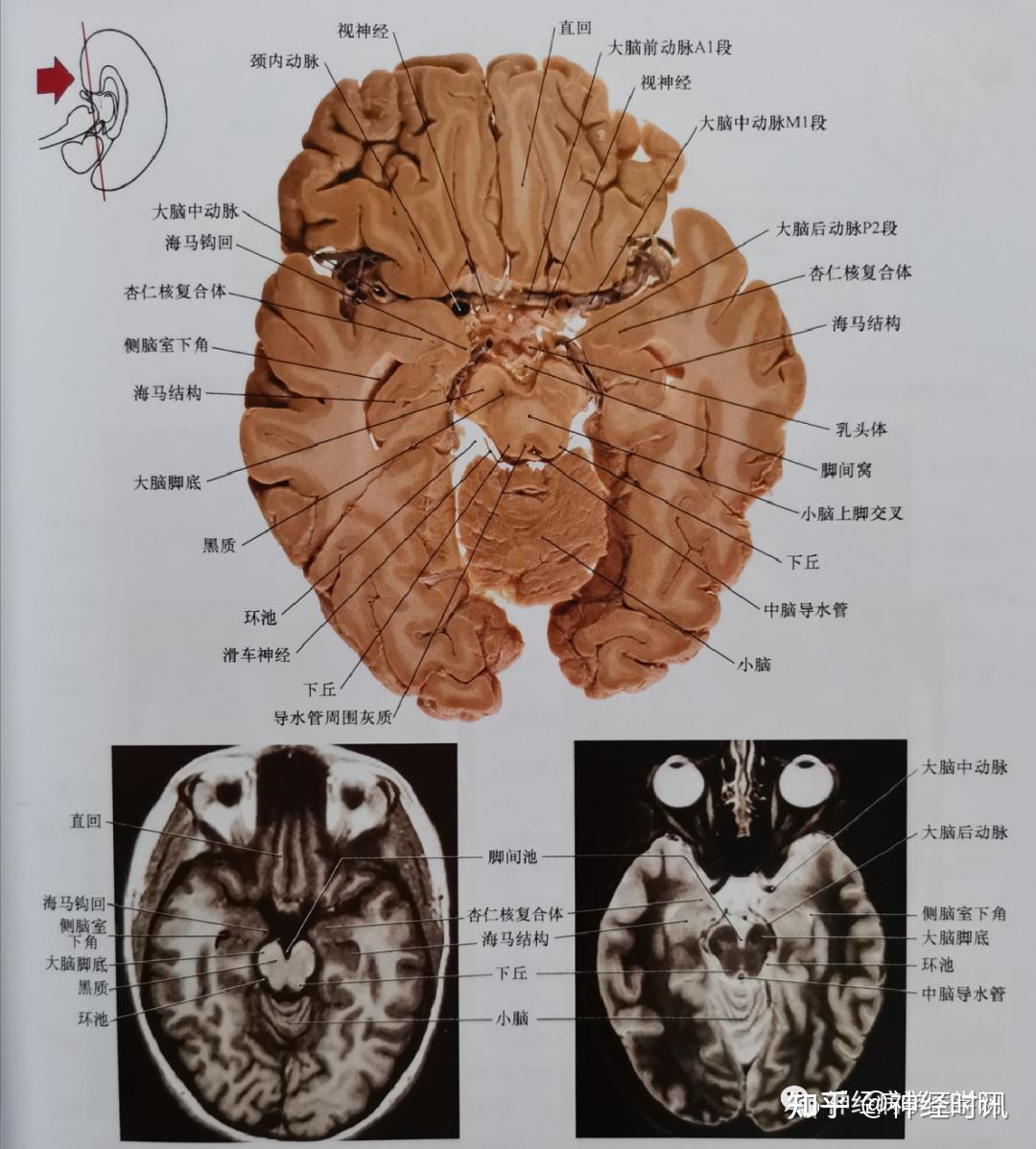 大脑解剖图环池图片
