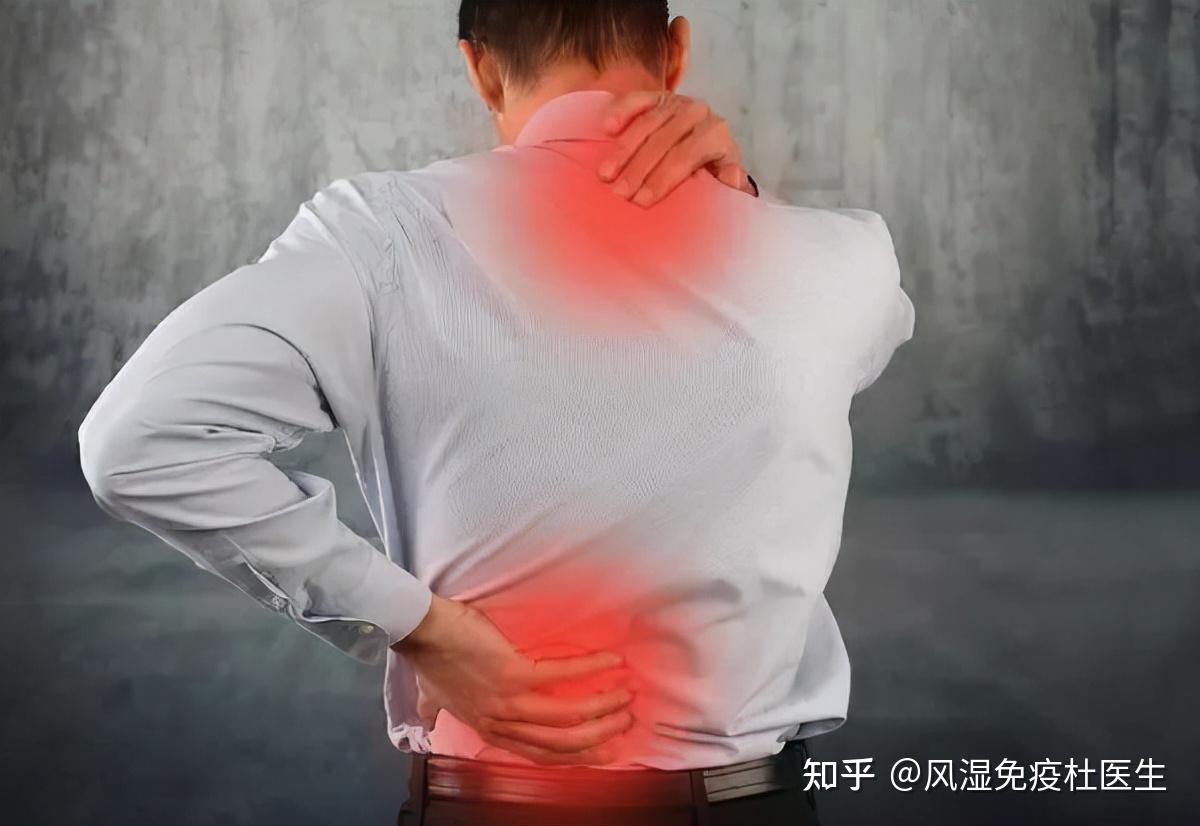 长时间腰痛真的这么简单吗有这几点症状你可能患有强直性脊柱炎