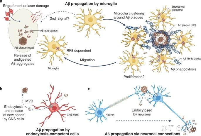神经退行性疾病机制篇2