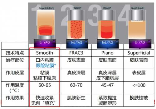 详细版区别来了,多方面多维度让你更好挑选欧洲之星4d和热玛吉1,从