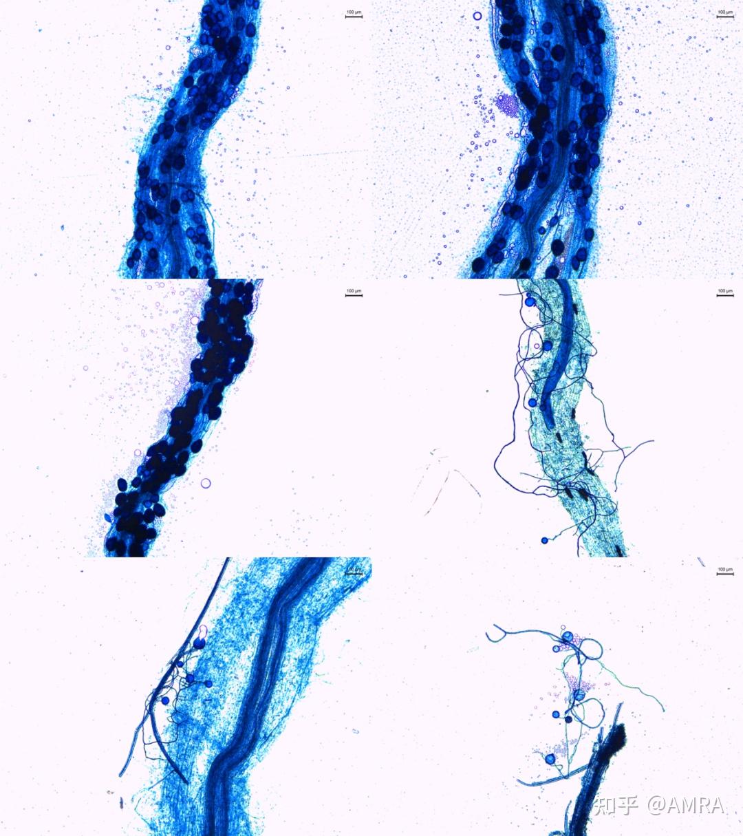 丛枝菌根显微镜图片