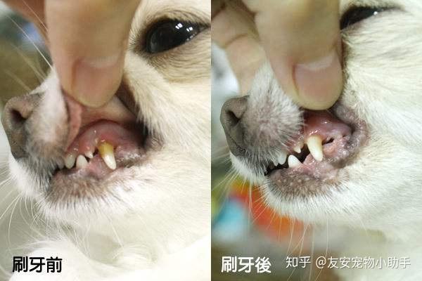 出去齿石,用盐水冲洗口腔,涂布碘甘油,切除或电烧烙除去肥大的牙龈