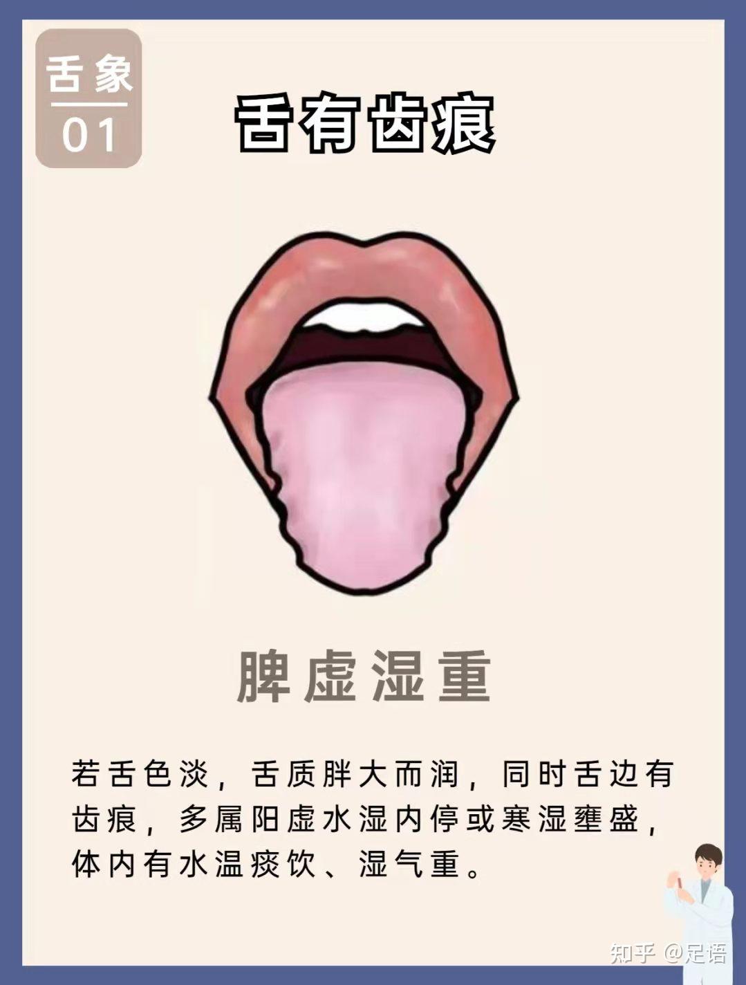 舌头下起泡是怎么回事。？ - 知乎