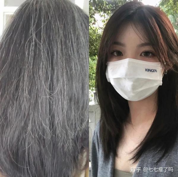 我年纪轻轻为什么这两年咻咻长出好多白头发? 并且都集中在头顶部?白头发怎么搞啊?真的是越拔掉越多吗? - 知乎