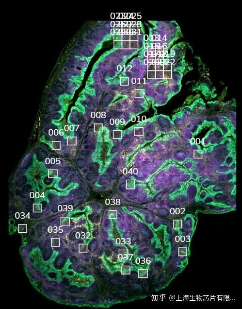 实测数据结果展示 | SBC顺利完成首批CosMx™ SMI空间原位分析实验！ - 知乎