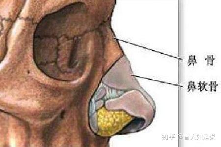 首大计成 鼻骨骨折常见的复位方法有哪些 知乎