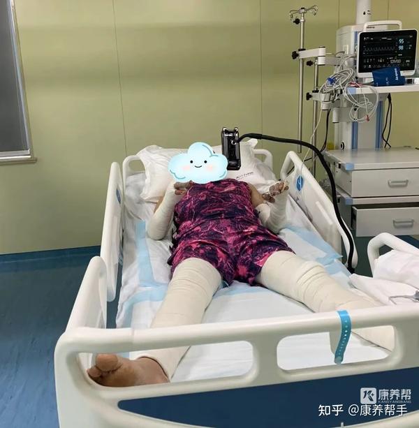 浙江大学康复医院转入杭州临平6·9火灾事件伤员,进行康复治疗! - 知乎