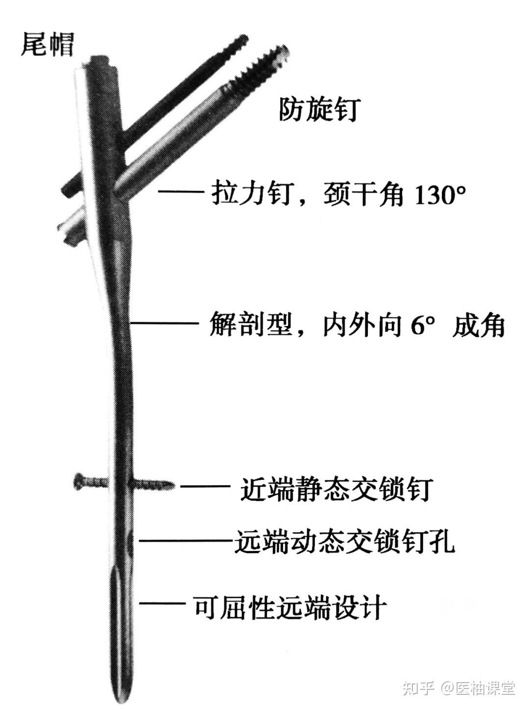 股骨颈骨折打钉示意图图片