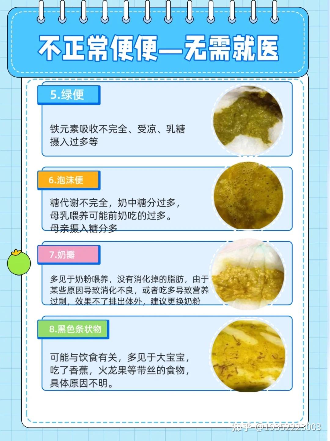 一文读懂婴儿粑粑蛋花状什么原因?