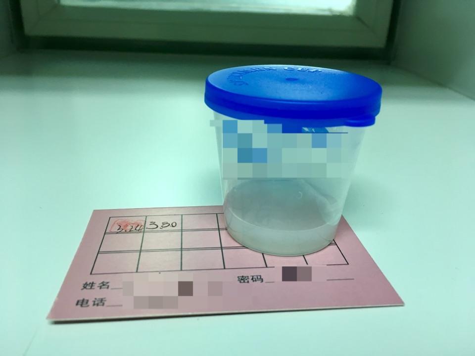 捐精是一种怎样的体验?