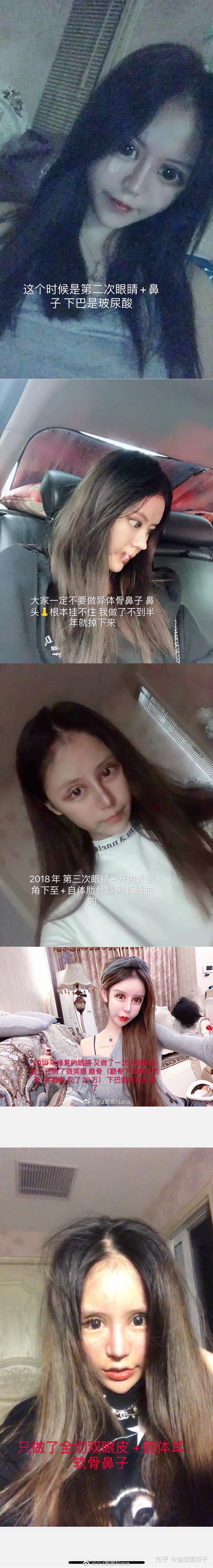 小z娜娜整容图片