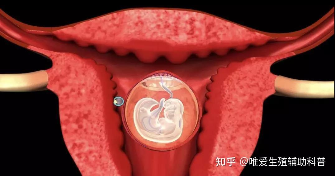 兩次懷孕都流產第一次出血第二次hcg值下降怎樣才能找到原因要檢查