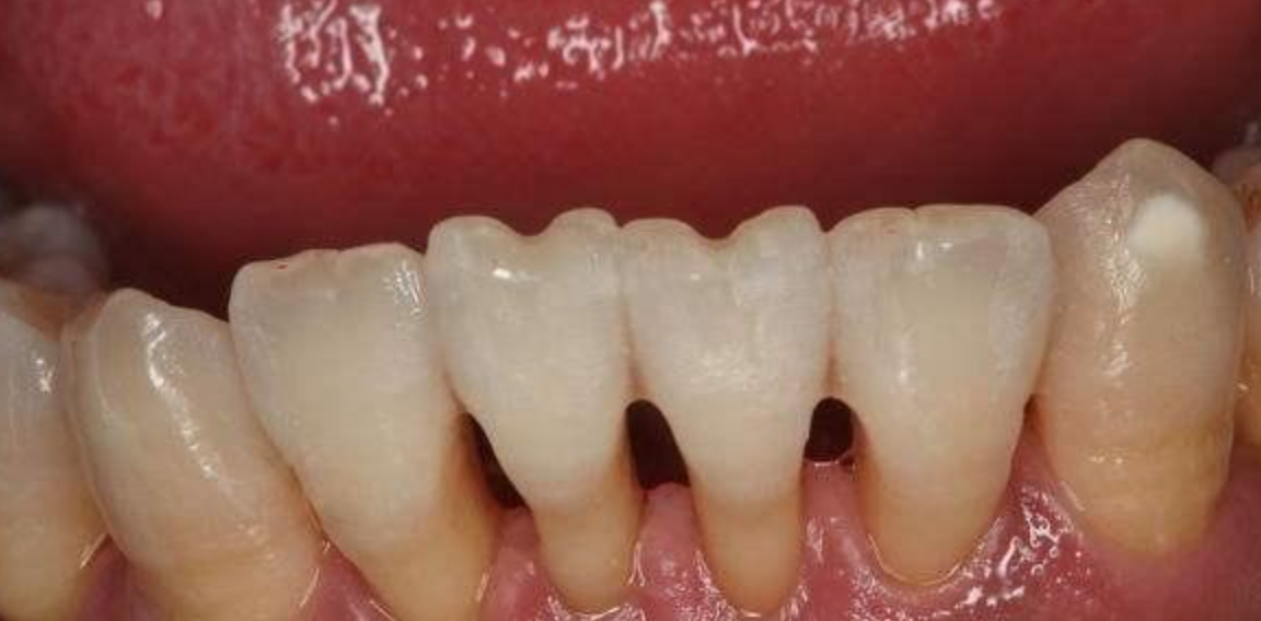 为什么会出现牙齿敏感牙敏感这个口腔问题该如何解决