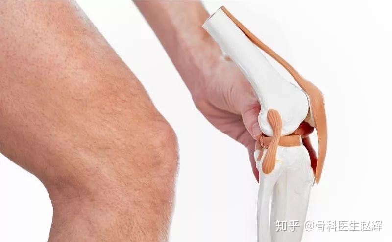 你的膝关节也会得肥胖症 髌下脂肪垫损伤 知乎