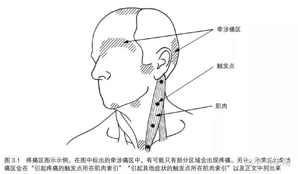 经常头痛 试试自我松解 胸锁乳突肌触发点按摩 知乎