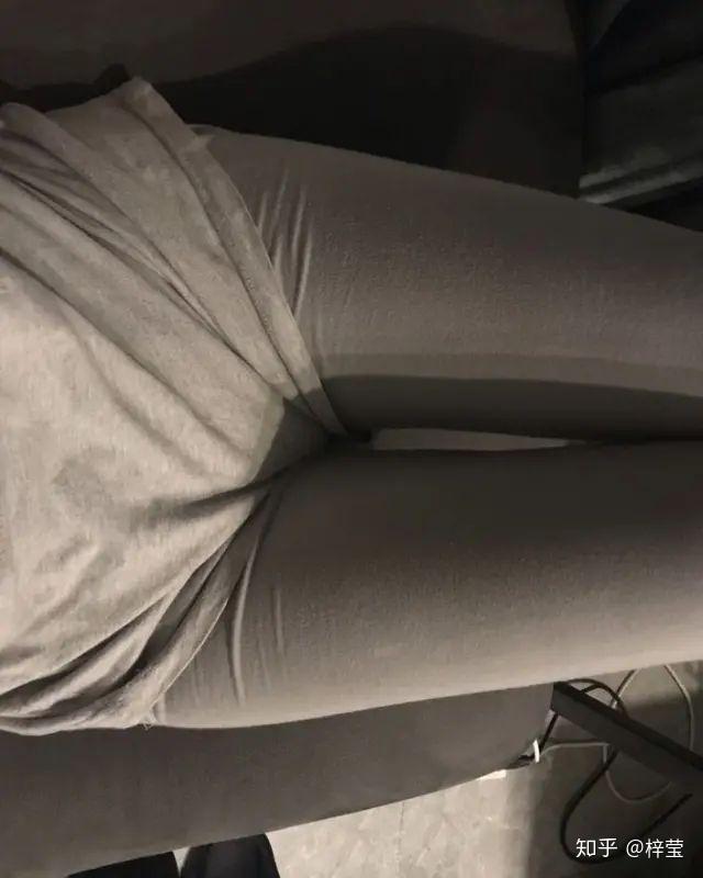 搞的留下这么大一疤在小腿,我后悔…(妈呀啊啊啊)我第一次发图片哈哈