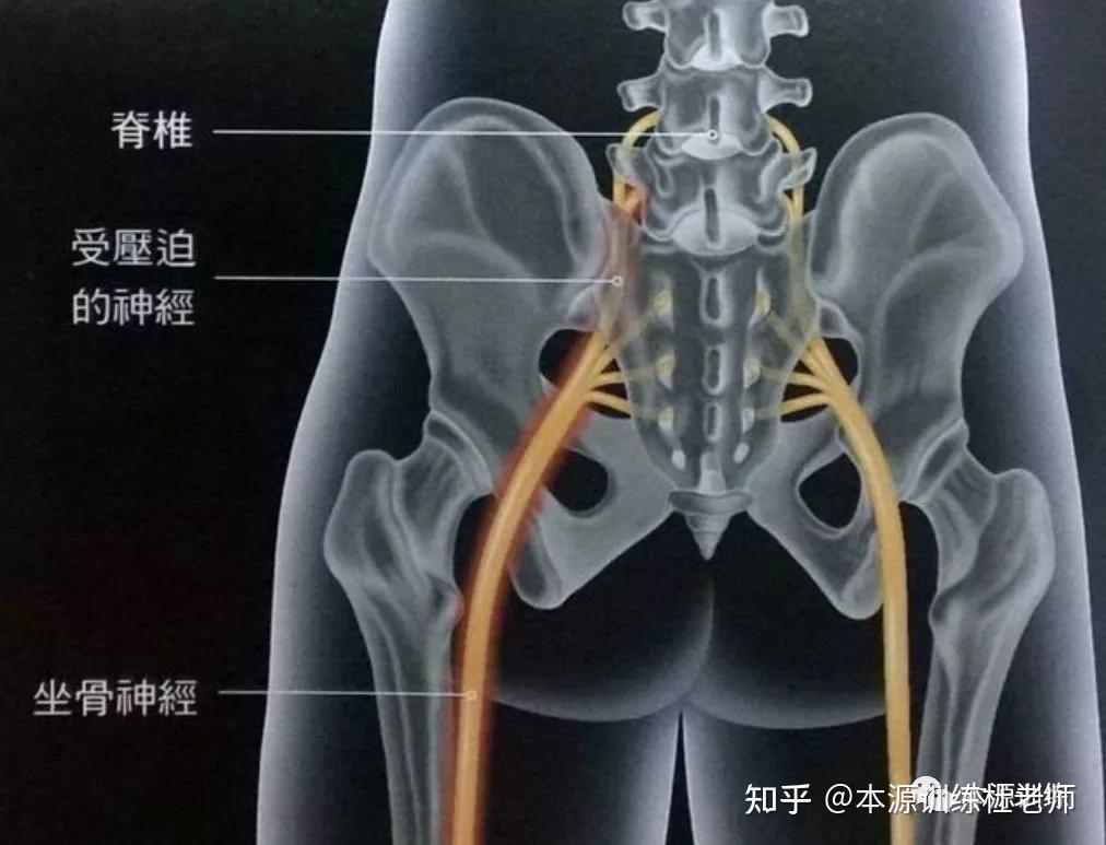 坐骨神经是哪个位置图片