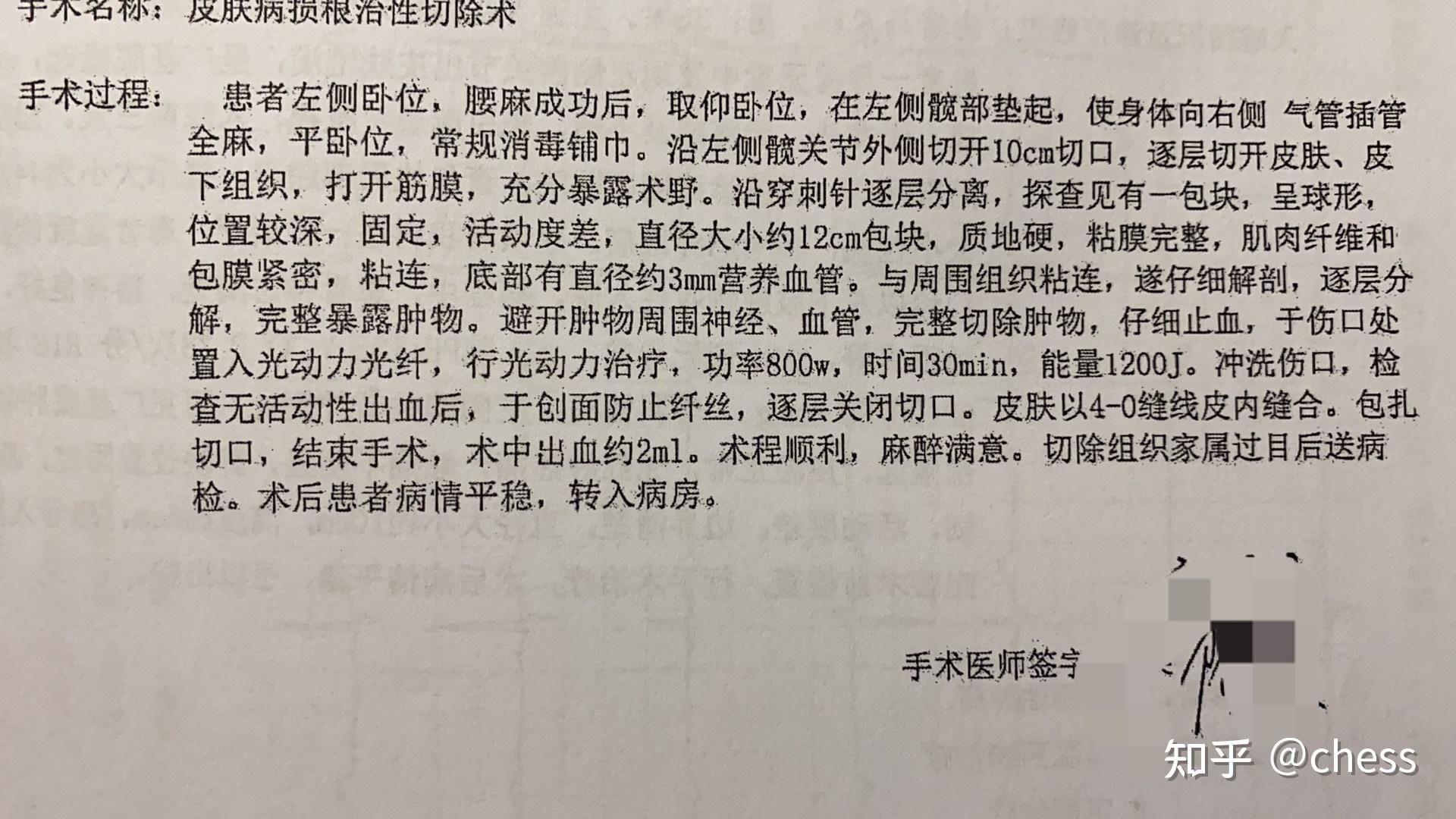 高分化脂肪肉瘤