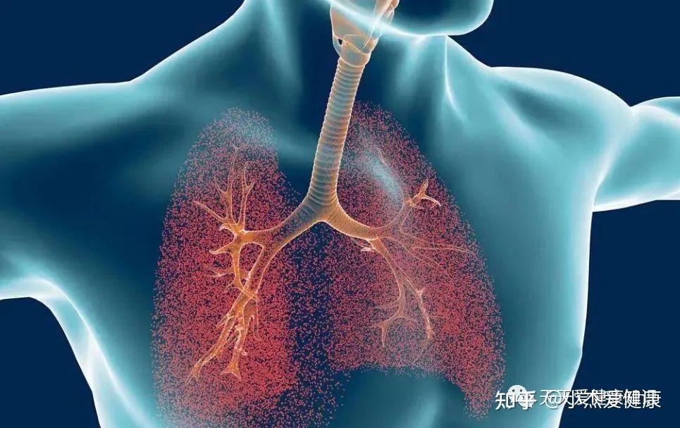 秋季支气管炎易复发？小儿支气管炎要做好这4点防止复发！ - 知乎