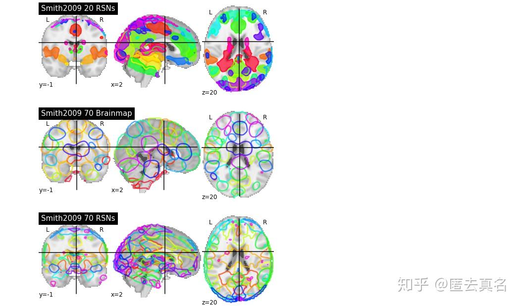 nilearn 笔记（5） - 知乎