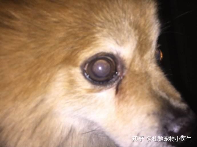 四,视网膜剥离