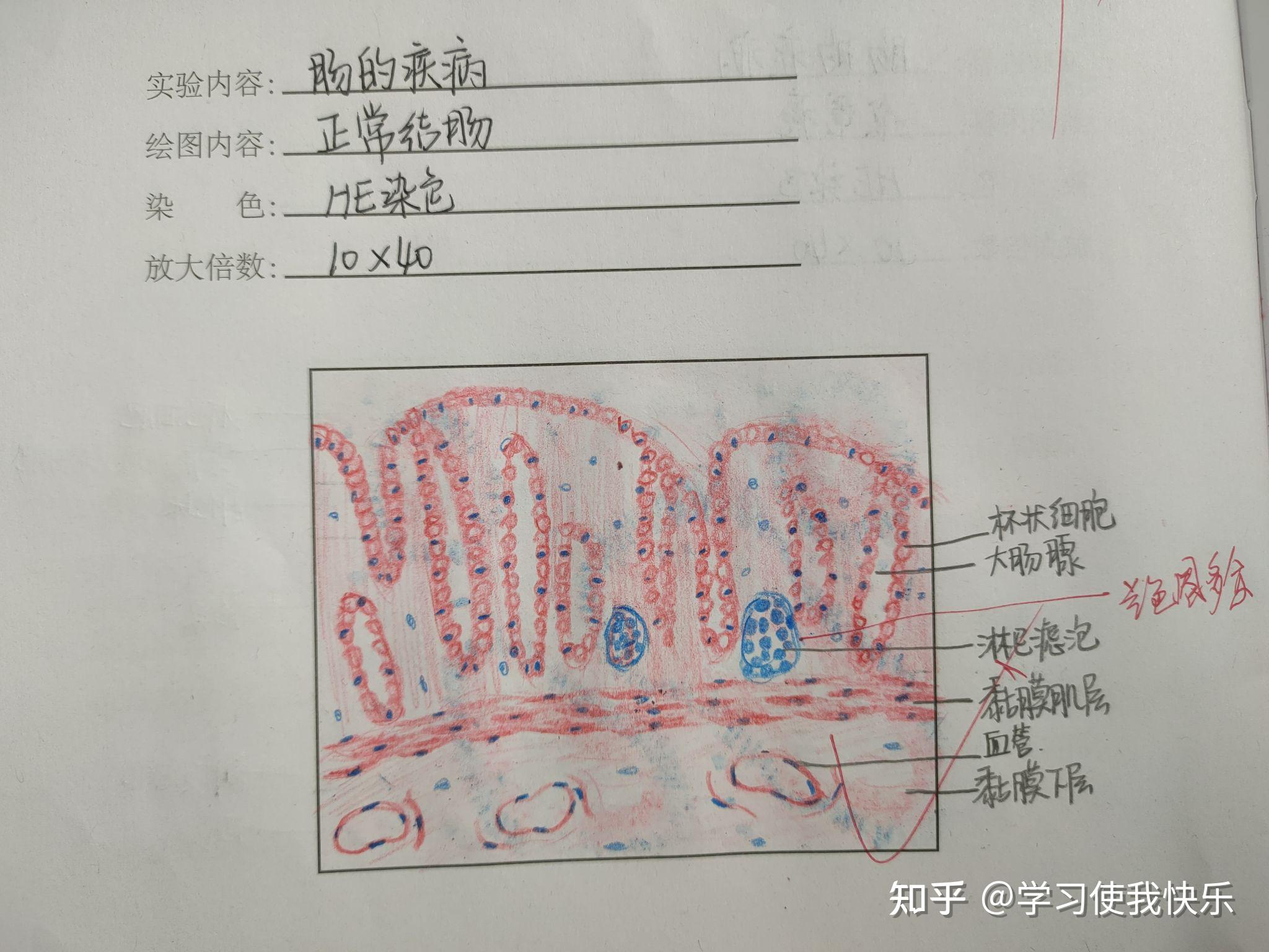 食道细胞手绘图图片