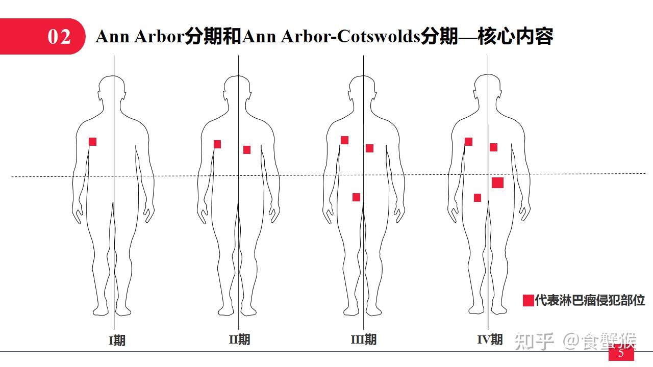 霍奇金淋巴瘤分期标准