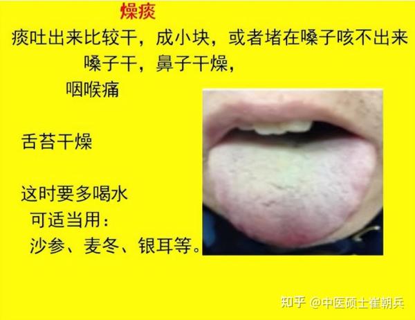“痰”为百病之源!湿痰、寒痰、风痰、燥痰?中医:教你一招,“挖”走老痰 - 知乎