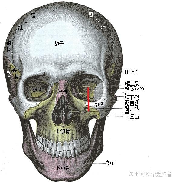 颧骨孔图片