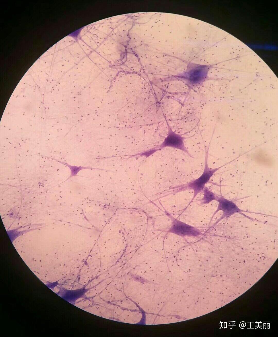 本人生物科学专业,人体结构为个体,系统,器官,组织,细胞.