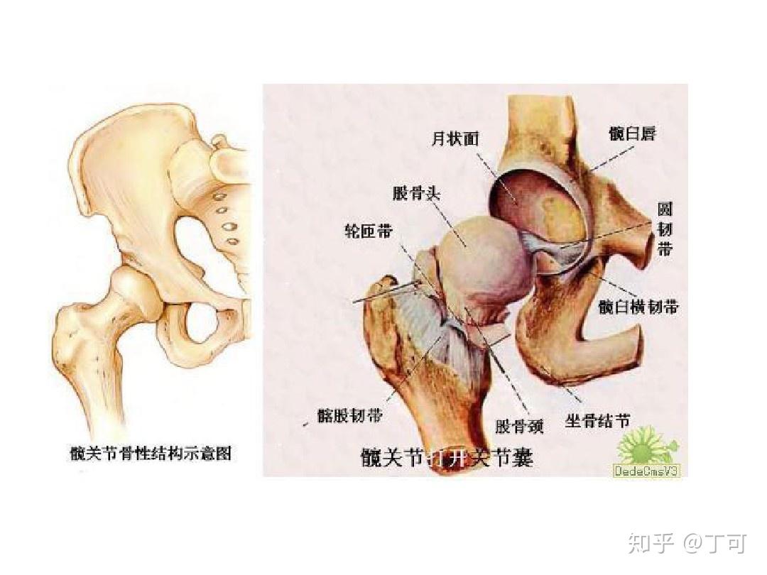 只有在外界突然强烈的冲髁ο,才会出现髋关节脱臼