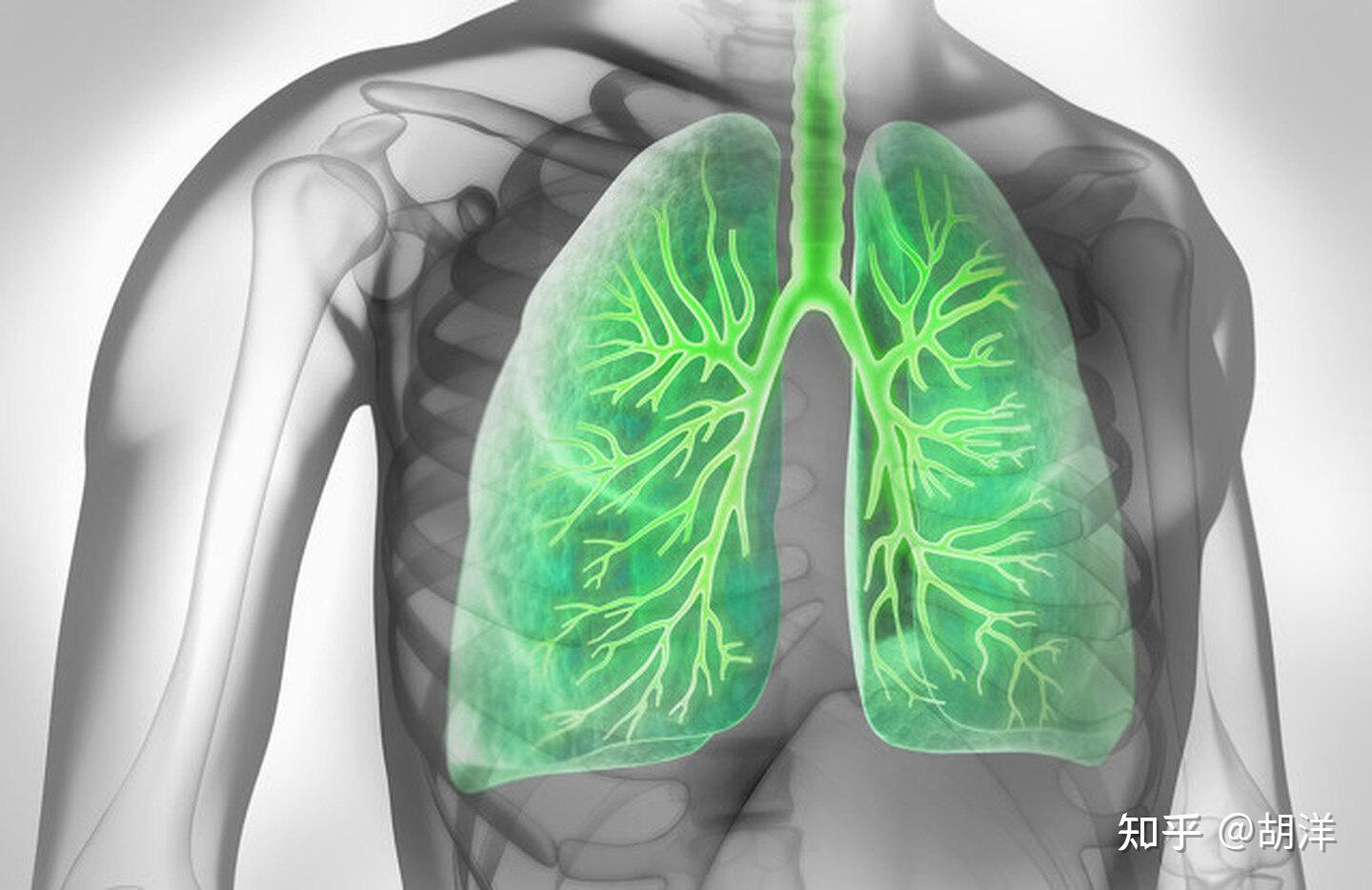 多例典型肺大泡的DR片，与大家分享！ - 医学影像学讨论版 - 爱爱医医学论坛