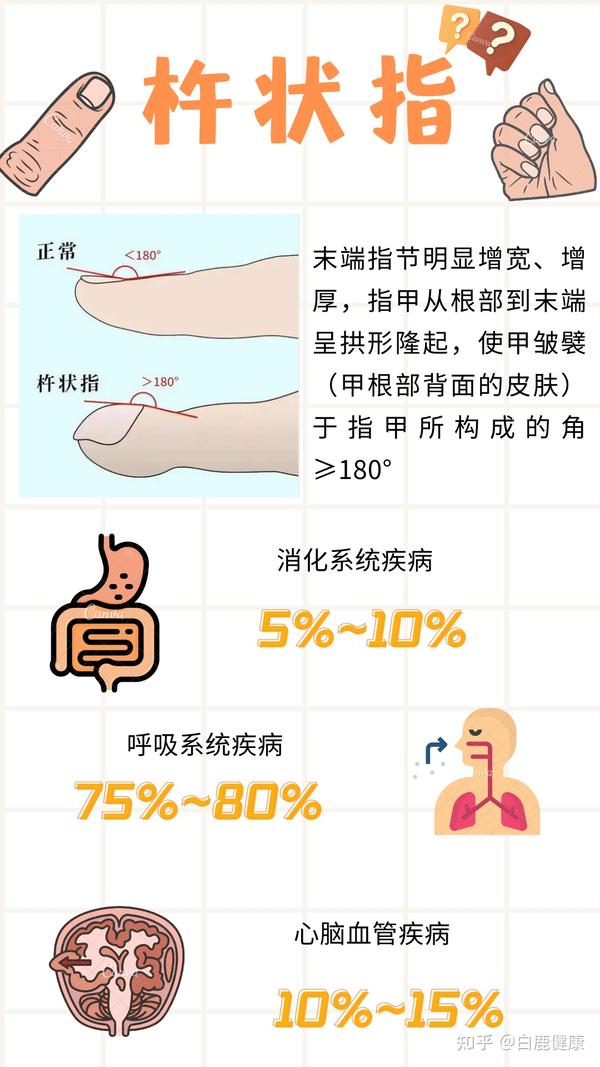 手指的一个小变化,竟是肺癌的征兆!杵状指为啥这么吓人? - 知乎