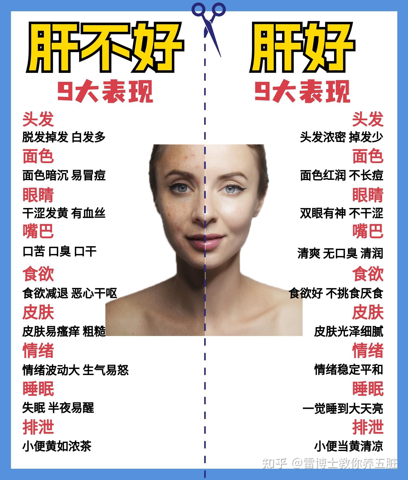 肝不好的9大表现 - 知乎