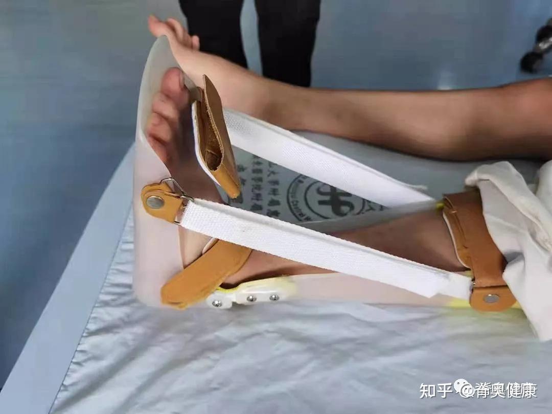 先天性马蹄内翻足为何需要穿矫正鞋