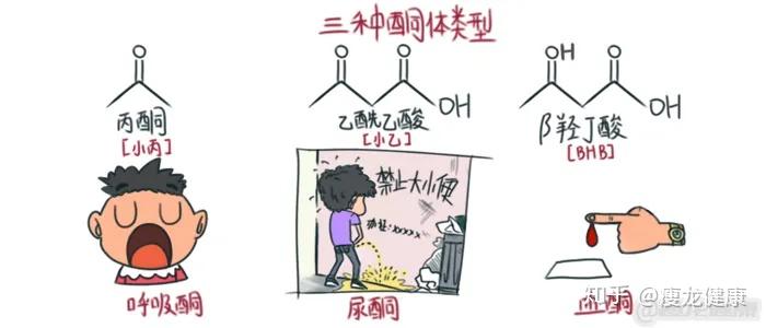 酮体有什么好处?哈佛学者Richard Veech告诉你…… - 知乎