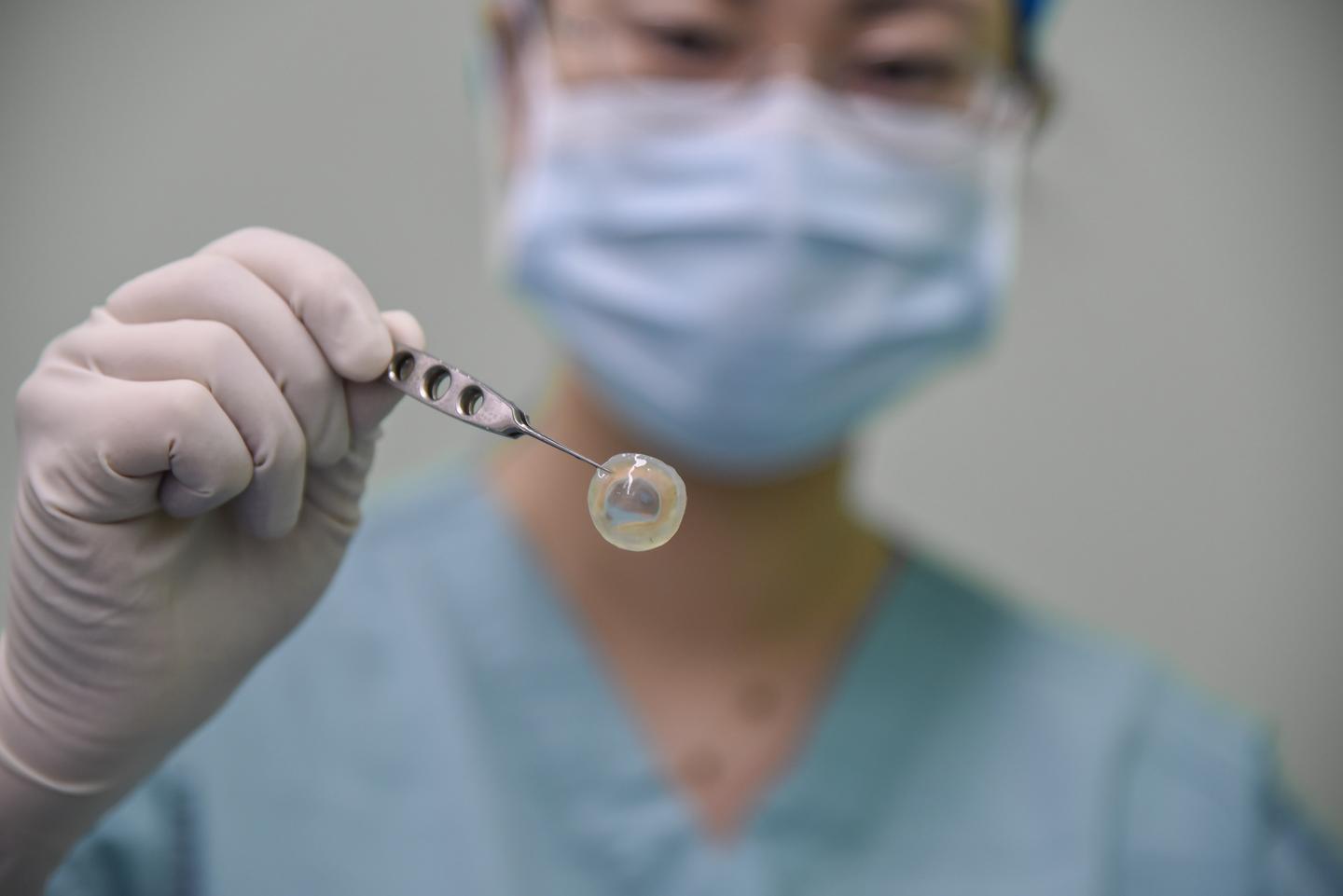 眼角膜是怎么捐献的 v2-d93add6d8729f1a2115b1dd99bfc855a_1440w.jpg?source=172ae18b