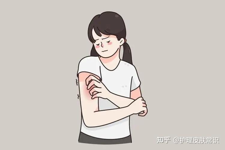 【肤康.科普】皮肤瘙痒时 挠痒,要注意哪些技巧? - 知乎