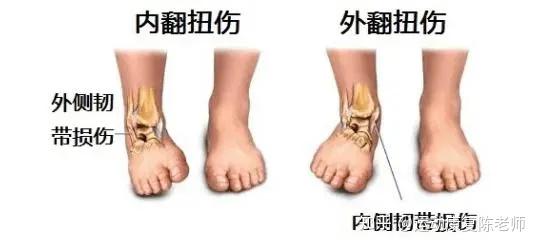 锐博康复高帮鞋一定更安全低帮一定更灵活