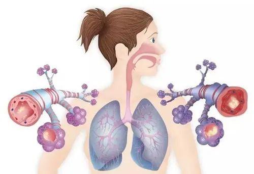 潓美氢氧医学应用于新冠患者康复的多中心临床实验正在武汉两家医院