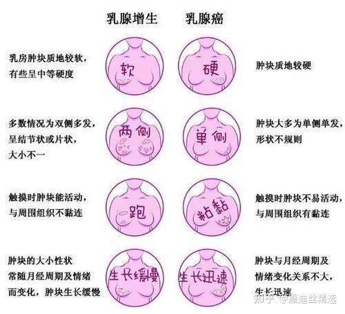 什么样的女性会得乳腺癌