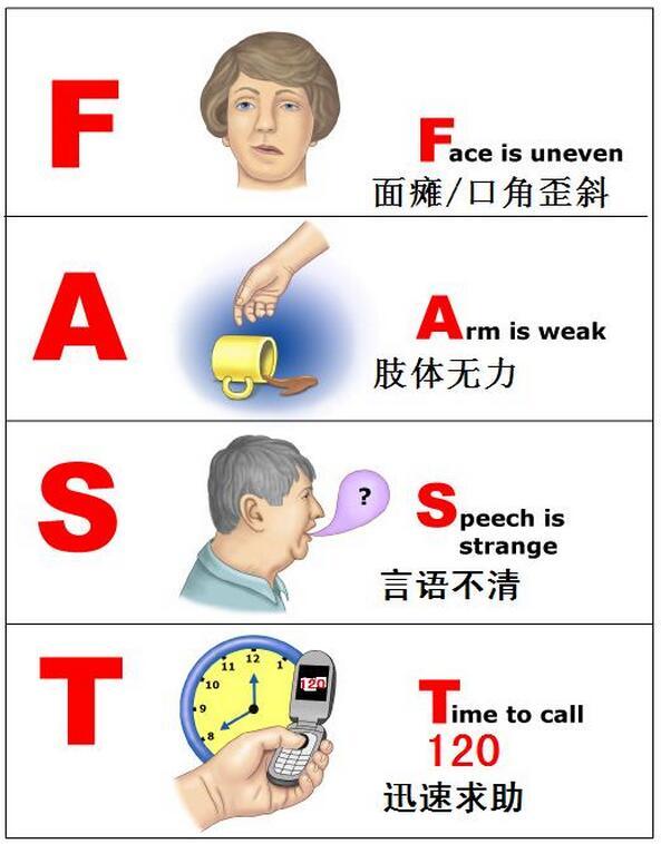 3个数 快速识别脑中风 知乎